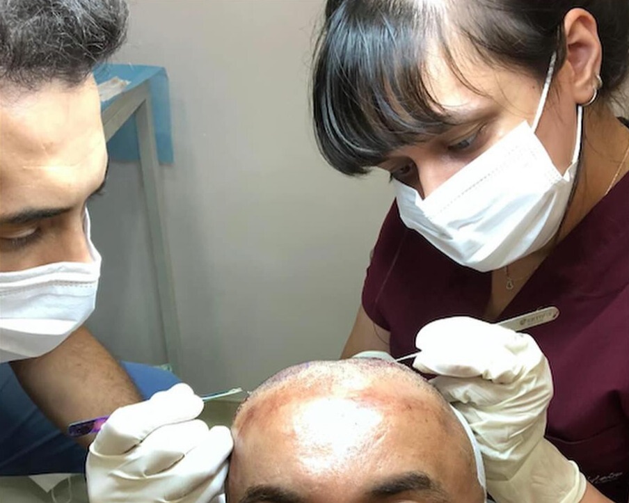 Berna Bayrak - Berna Hair Clinic